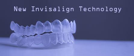 Invisalign™