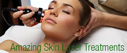 Skin Laser