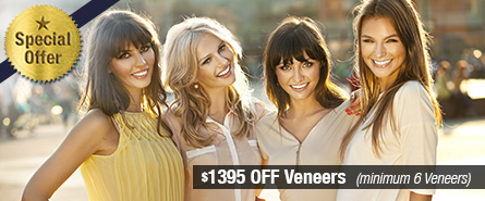 Veneers Special